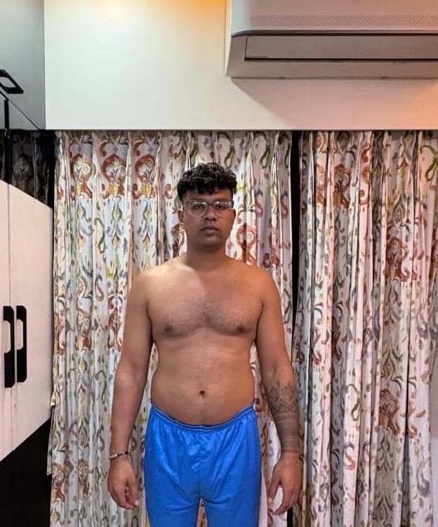 Before: client wearing blue shorts and glasses, standing in front of curtains.